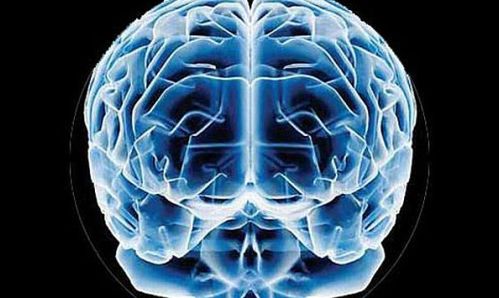 escaneo del cerebro