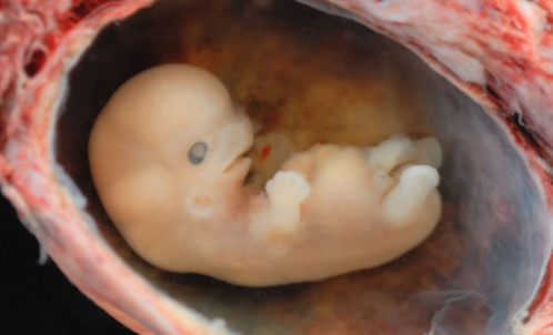 feto en el utero