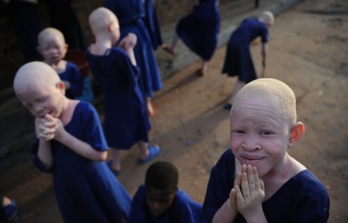 albinos vetidos de azul en tanzania