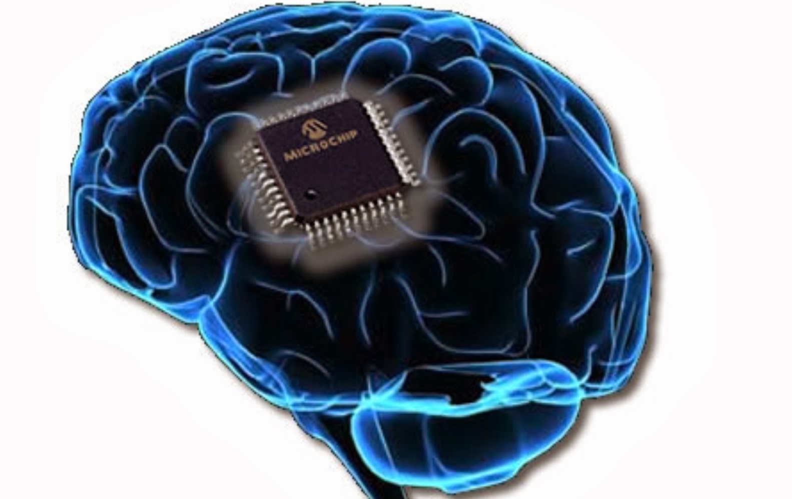 Resultado de imagen de dispositivos rfid en el cerebro