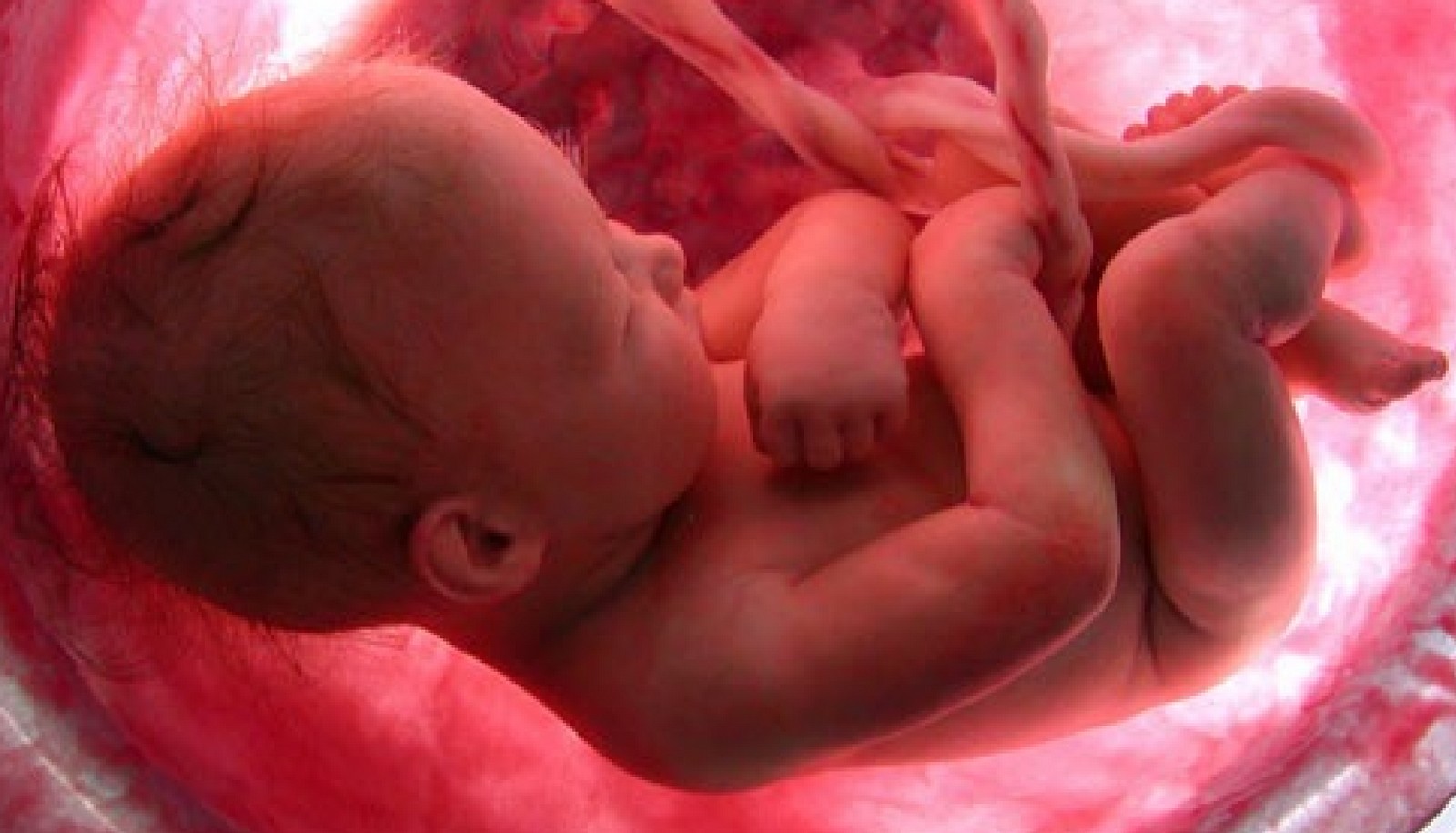 Investigador Denuncia que se está Encubriendo la Relación entre el Aborto y el Desarrollo de CÁNCER DE MAMA…